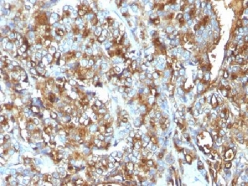 MUC1 Antibody / Mucin-1 / EMA