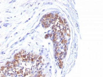 MUC1 Antibody / Mucin-1 / EMA