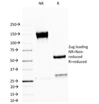 MUC1 Antibody / Mucin-1 / EMA