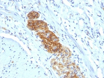 NCAM Antibody