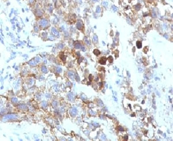 CD56 Antibody / NCAM / Extracellular domain