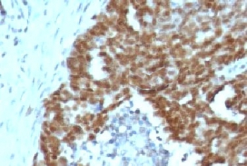 Nucleolin Antibody