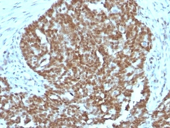 Nucleolin Antibody Cocktail
