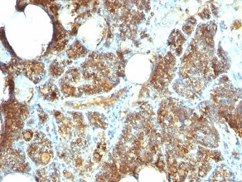 Parathyroid Hormone Antibody / C-Terminal
