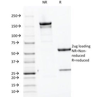 PTH Antibody / C-Terminal