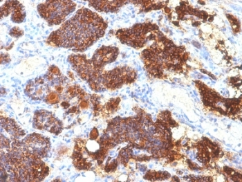 PTH Antibody / C-Terminal