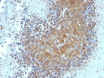 Bax Antibody