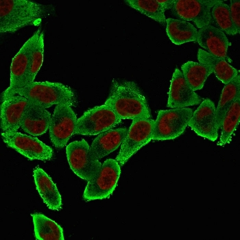 Alpha Smooth Muscle Actin Antibody