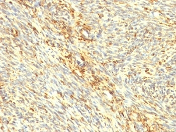Transglutaminase 2 Antibody