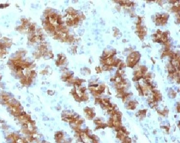 TNF-alpha Antibody
