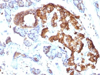 TNF-alpha Antibody