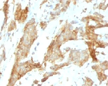 gp96 Antibody / GRP94 / HSP90B1