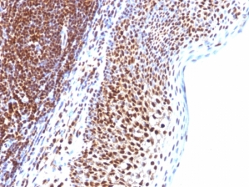 SUMO-1 Antibody