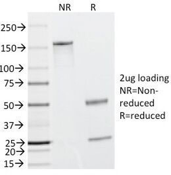 CAD Antibody / Caldesmon / CALD1 (HMW)
