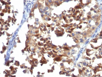 LAMP-3 Antibody / CD63