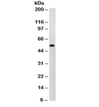 Cytokeratin 10/13 Antibody