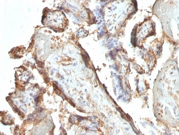 hCG Holo Antibody