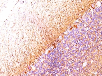Neurofilament Antibody Cocktail