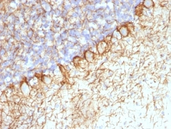 Neurofilament Antibody Cocktail