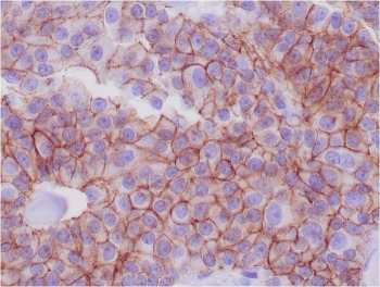 E-Cadherin Antibody / CDH1