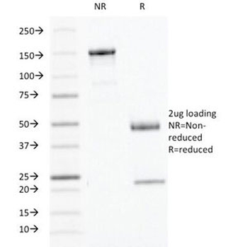 IFN gamma Antibody