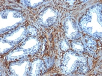 Galectin 1 Antibody