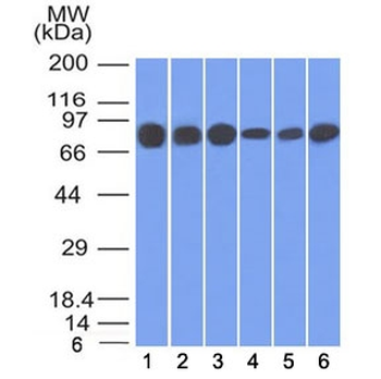 Plakoglobin Antibody / Gamma Catenin