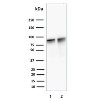 Plakoglobin Antibody / Gamma Catenin