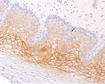 Plakoglobin Antibody / Gamma Catenin
