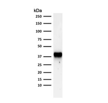 AMACR Antibody (Prostate Cancer Marker)