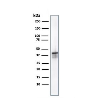 AMACR Antibody (Prostate Cancer Marker)