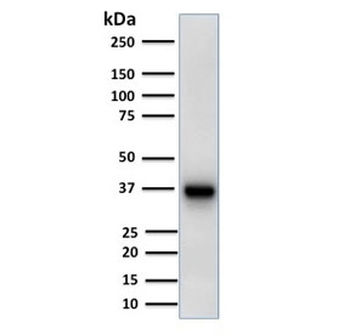 AMACR Antibody (Prostate Cancer Marker)