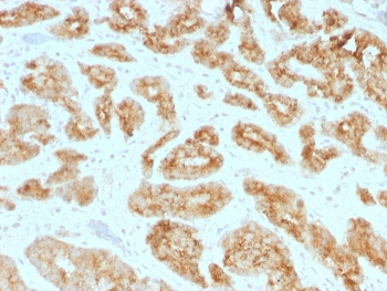AMACR Antibody (Prostate Cancer Marker)