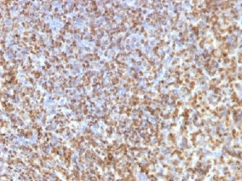 Galectin 13 Antibody / LGALS13