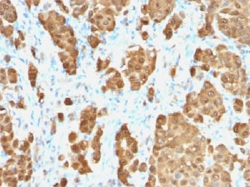 Recombinant S100B Antibody / Rabbit Monoclonal