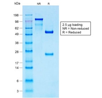 Recombinant S100B Antibody / Rabbit Monoclonal