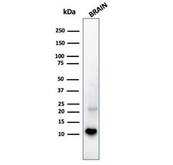 Recombinant S100B Antibody / Rabbit Monoclonal