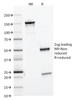 Ferritin Light Chain Antibody