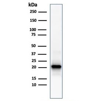 Ferritin Light Chain Antibody