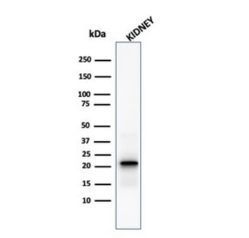 Ferritin Light Chain Antibody