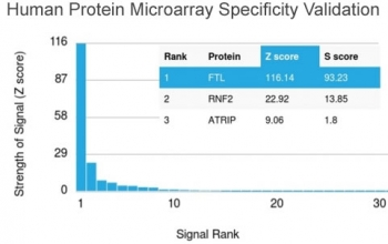 Ferritin Light Chain Antibody