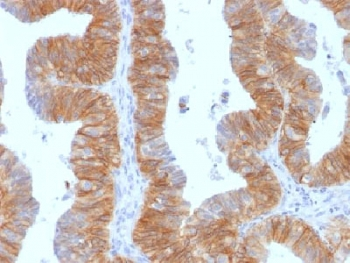 EpCAM Antibody / Extracellular domain