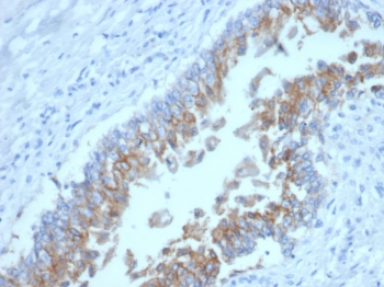 EpCAM Antibody / Extracellular domain