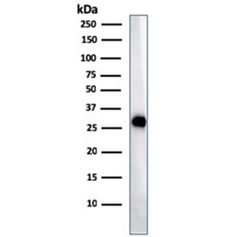 HLA-DP/DQ/DR Antibody (MHC II)