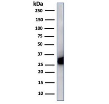 HLA-DP/DQ/DR Antibody (MHC II)