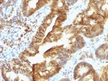 TDP2 Antibody / Tyrosyl-DNA phosphodiesterase 2 / ETS1 associated protein II