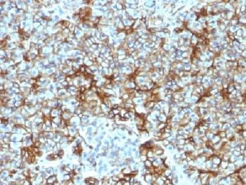 Spectrin beta III Antibody / SPTBN2