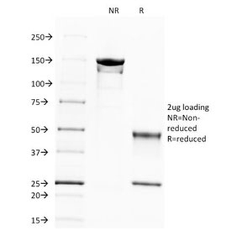 Spectrin beta III Antibody / SPTBN2
