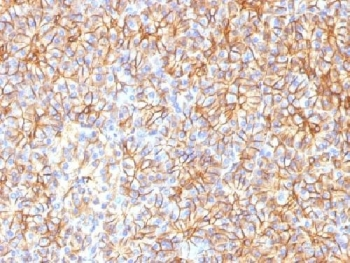 Spectrin beta III Antibody / SPTBN2