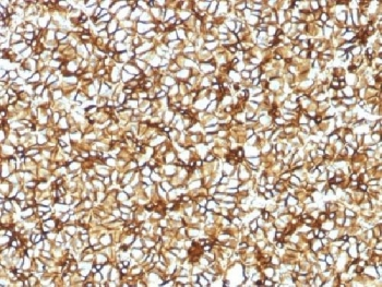 Spectrin beta III Antibody / SPTBN2
